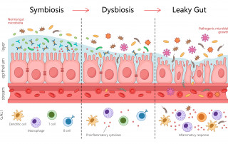 leaky gut syndrom